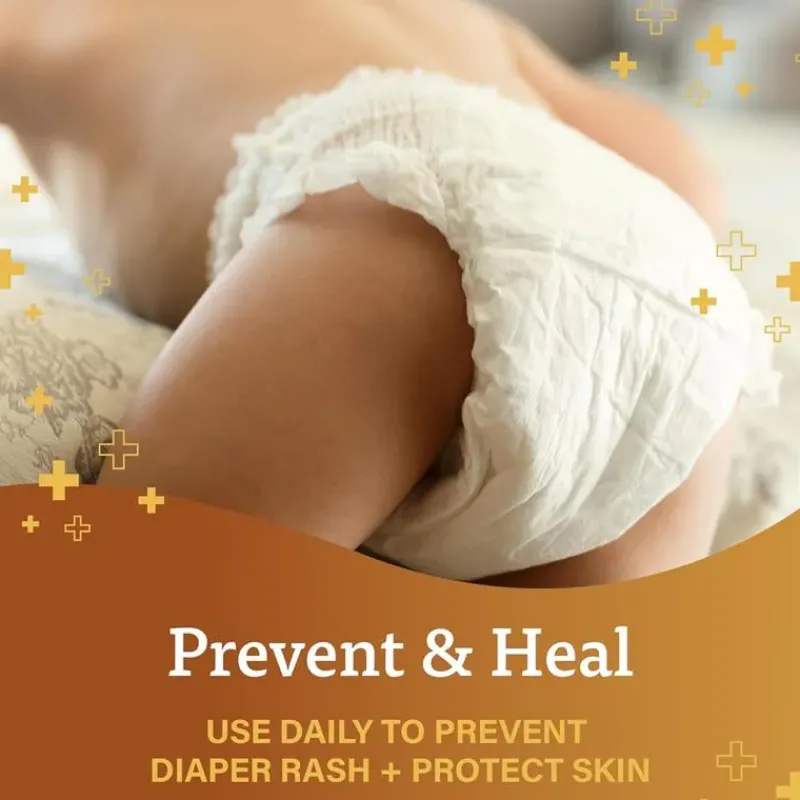 MacroBaby Diaper Rash*A+D - Original Diaper Rash Ointment 16Oz