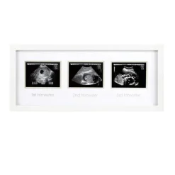 Pearhead Baby Baby Shower|Gifts Up To $25*Pearhead - Trimester Sonogram Frame, White